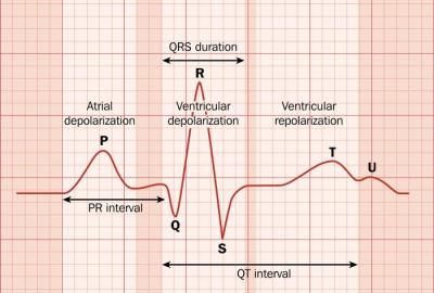 ECG analysis Training Course