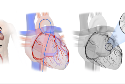 Diagnostic & Interventional Cardiac Catheterization professional diploma